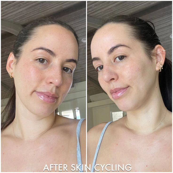 Rahasia Kulit Glowing Maksimal Tanpa Iritasi dengan Skin Cycling