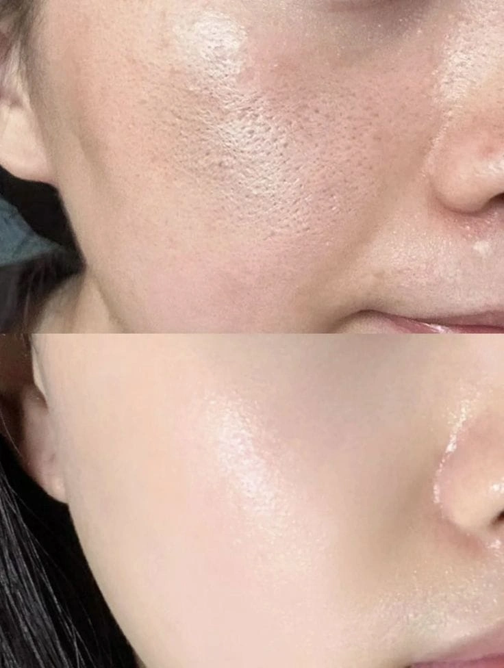 Panduan Lengkap Skin Minimalist Manfaat dan Cara Penggunaannya