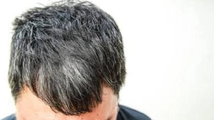 Penyebab Rambut Beruban dan Fakta Medis Apakah Uban Bisa Kembali Hitam
