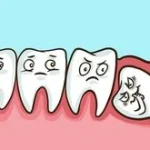 Dilema Gigi Bungsu: Apakah Harus Selalu Dicabut?