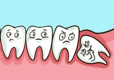 Dilema Gigi Bungsu: Apakah Harus Selalu Dicabut?