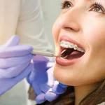 Jangan Asal Pasang Behel! Ini Alasan Harus ke Orthodontist