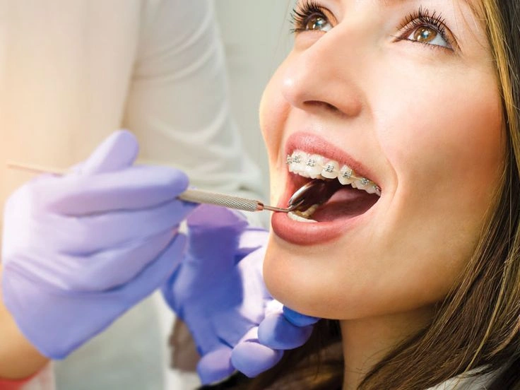 Jangan Asal Pasang Behel! Ini Alasan Harus ke Orthodontist