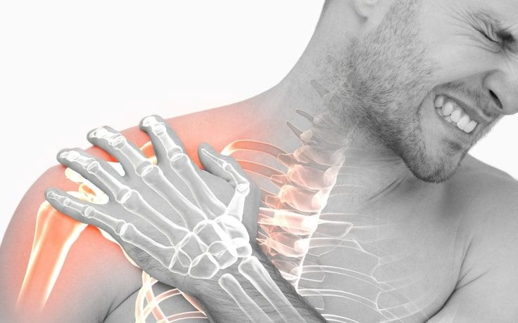 Frozen Shoulder Diam-Diam Bikin Bahu Kaku, Ini Penyebabnya!